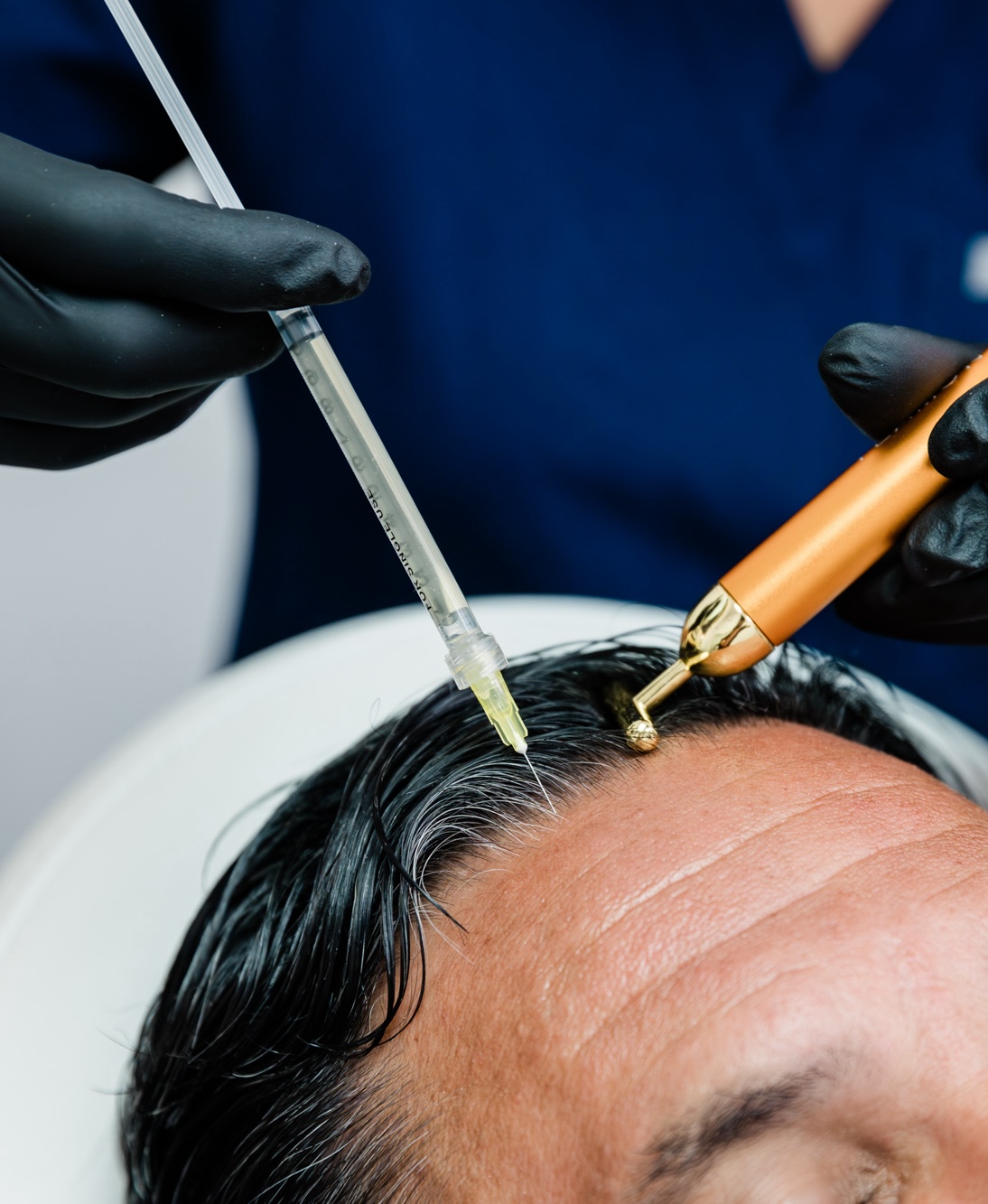 Provider injecting PRP into a patient's scalp during hair restoration near Wicker Park at ReJenerate Aesthetic Studio.